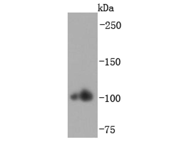 alpha Actinin 2 Antibody in Western Blot (WB)