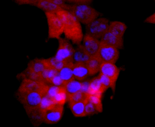 SOD1 Antibody in Immunocytochemistry (ICC/IF)