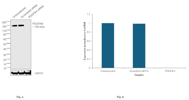 PDGFRA Antibody in Western Blot (WB)