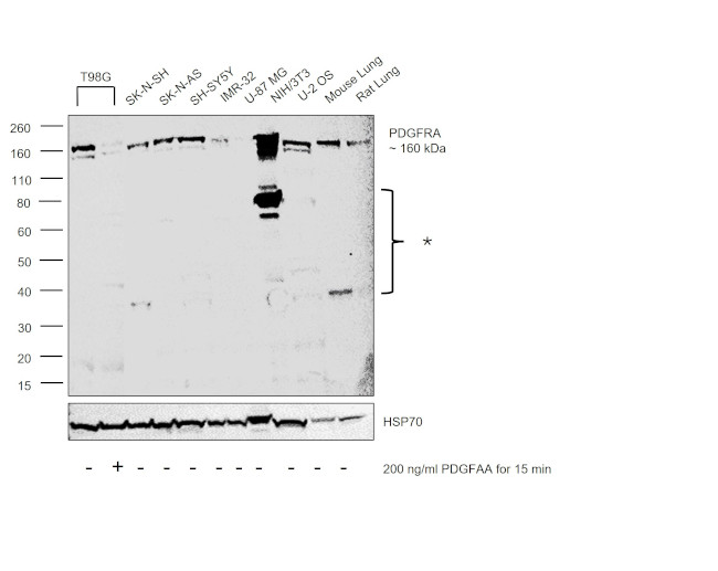 PDGFRA Antibody in Western Blot (WB)