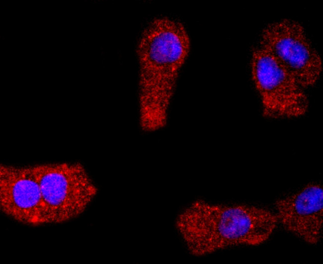 PDGFRA Antibody in Immunocytochemistry (ICC/IF)