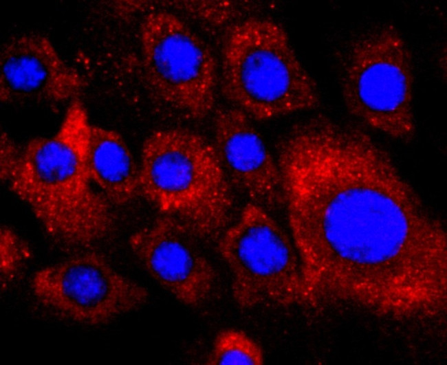 PDGFRA Antibody in Immunocytochemistry (ICC/IF)