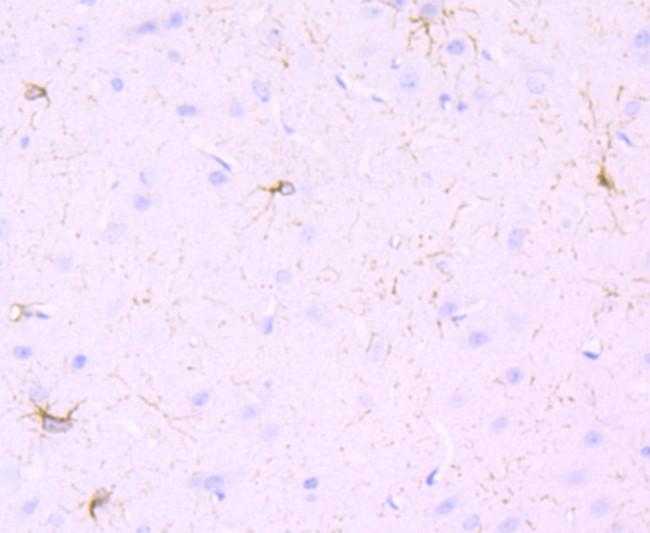 PDGFRA Antibody in Immunohistochemistry (Paraffin) (IHC (P))