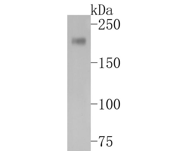 PDGFRA Antibody in Western Blot (WB)