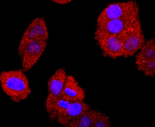 Bcl-2 Antibody in Immunocytochemistry (ICC/IF)