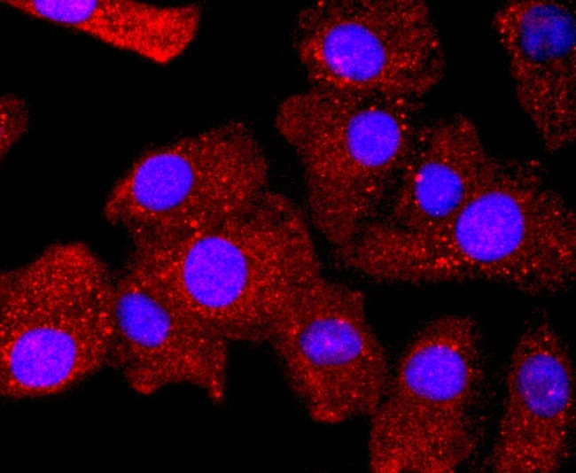 Bcl-2 Antibody in Immunocytochemistry (ICC/IF)