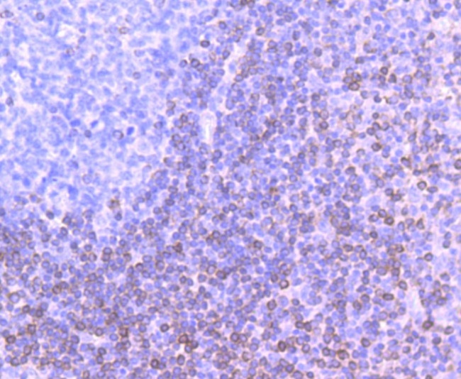 Bcl-2 Antibody in Immunohistochemistry (Paraffin) (IHC (P))