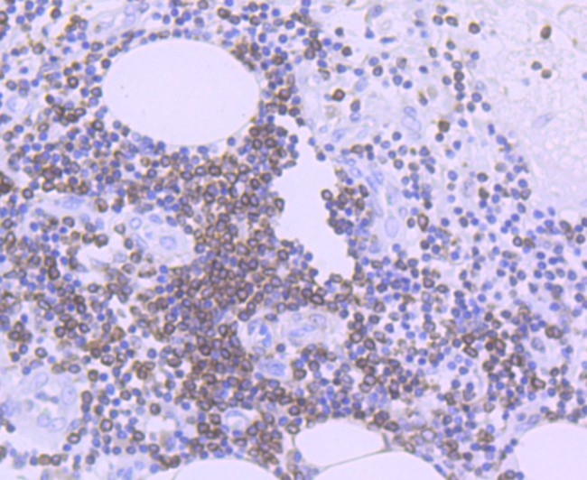 Bcl-2 Antibody in Immunohistochemistry (Paraffin) (IHC (P))