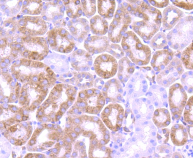 Bcl-2 Antibody in Immunohistochemistry (Paraffin) (IHC (P))