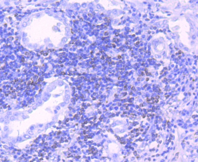 Bcl-2 Antibody in Immunohistochemistry (Paraffin) (IHC (P))