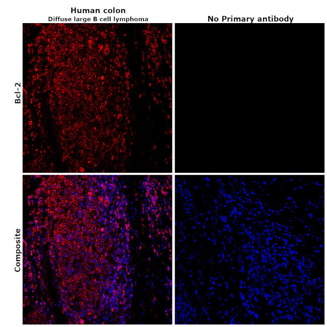 Bcl-2 Antibody in Immunohistochemistry (Paraffin) (IHC (P))