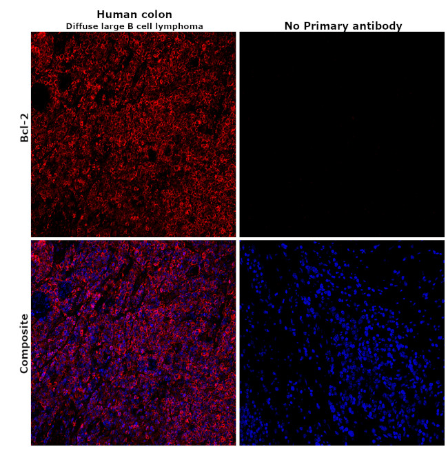 Bcl-2 Antibody in Immunohistochemistry (Paraffin) (IHC (P))