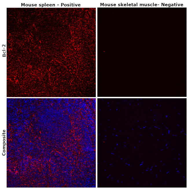 Bcl-2 Antibody in Immunohistochemistry (Paraffin) (IHC (P))