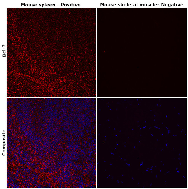 Bcl-2 Antibody in Immunohistochemistry (Paraffin) (IHC (P))