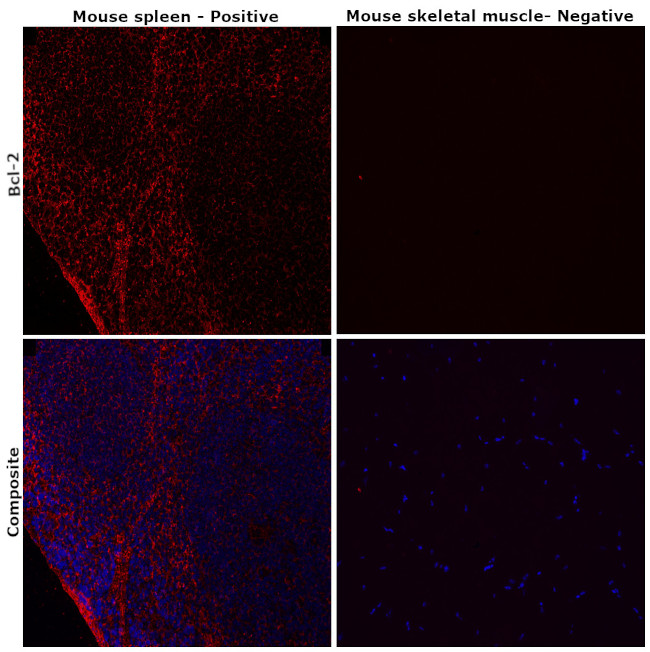 Bcl-2 Antibody in Immunohistochemistry (Paraffin) (IHC (P))