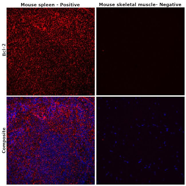 Bcl-2 Antibody in Immunohistochemistry (Paraffin) (IHC (P))