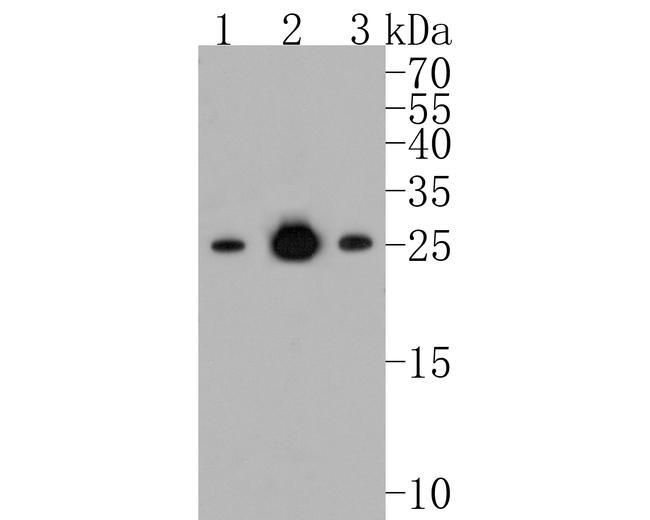 Bcl-2 Antibody in Western Blot (WB)