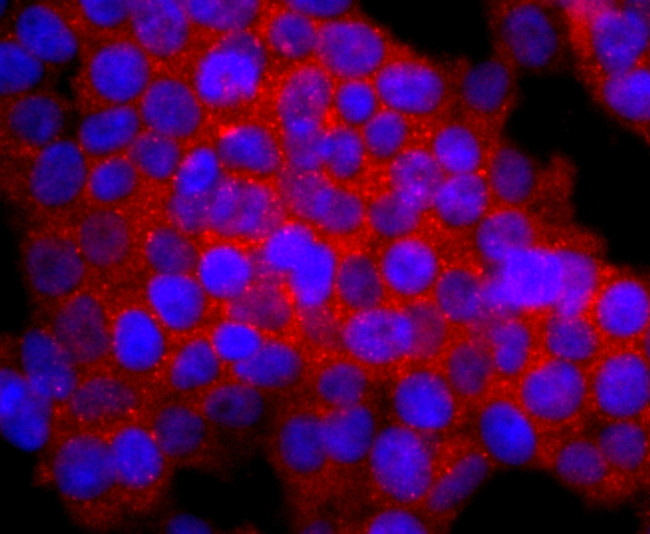 Calbindin D28K Antibody in Immunocytochemistry (ICC/IF)