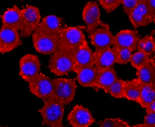 Parkin Antibody in Immunocytochemistry (ICC/IF)