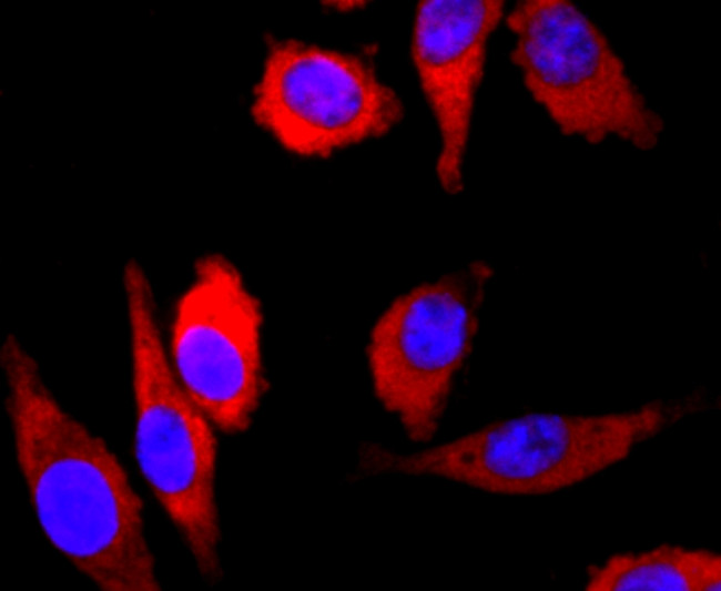 Parkin Antibody in Immunocytochemistry (ICC/IF)