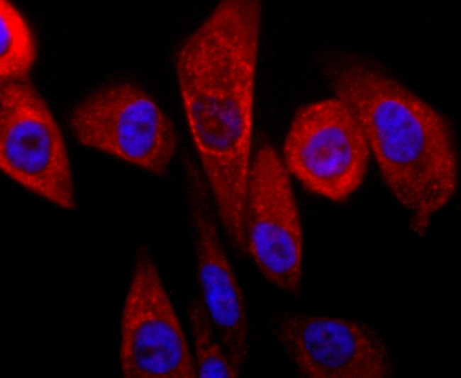 Parkin Antibody in Immunocytochemistry (ICC/IF)