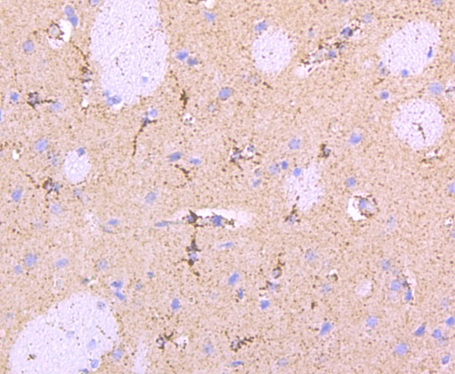 Parkin Antibody in Immunohistochemistry (Paraffin) (IHC (P))