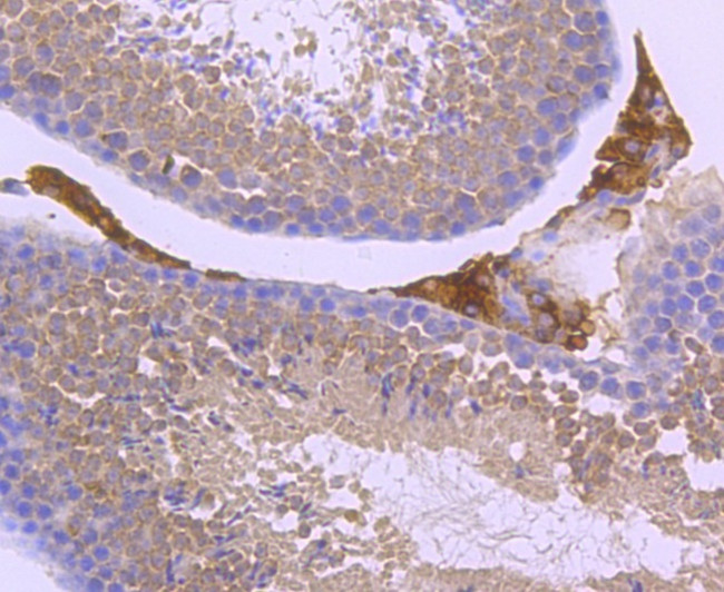 Parkin Antibody in Immunohistochemistry (Paraffin) (IHC (P))