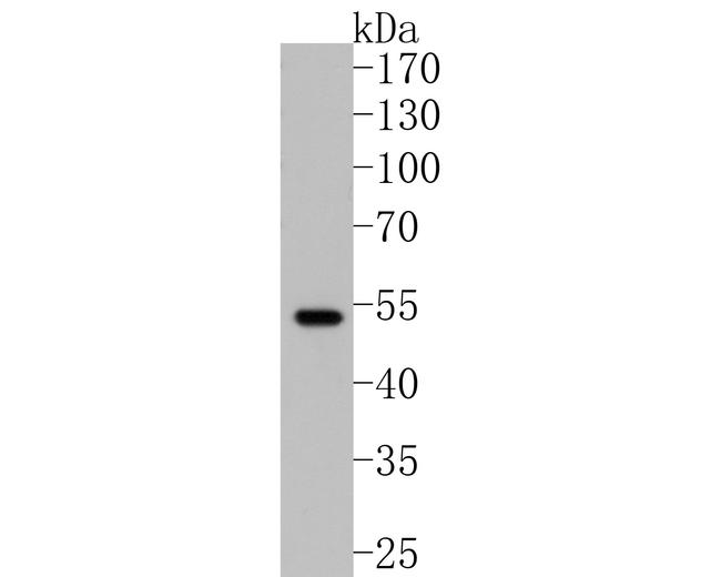 Parkin Antibody in Western Blot (WB)