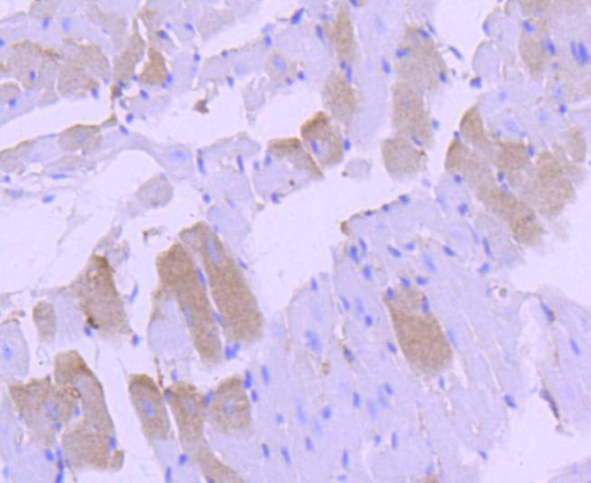 p38 MAPK Antibody in Immunohistochemistry (Paraffin) (IHC (P))