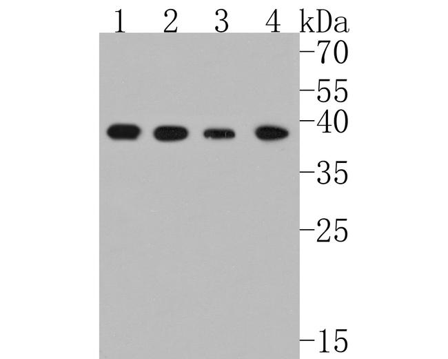 p38 MAPK Antibody in Western Blot (WB)