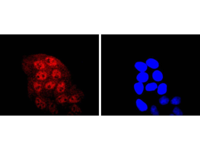 KLF4 Antibody in Immunocytochemistry (ICC/IF)