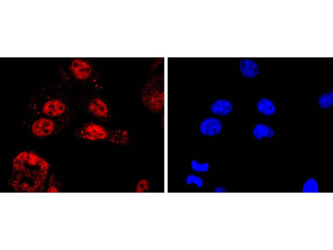 KLF4 Antibody in Immunocytochemistry (ICC/IF)