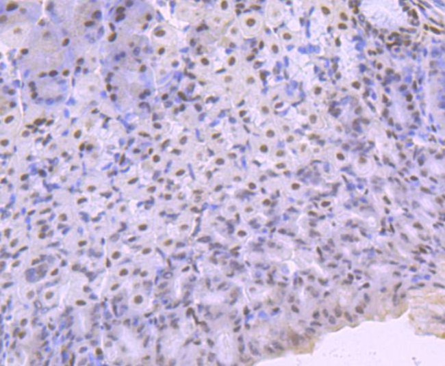 KLF4 Antibody in Immunohistochemistry (Paraffin) (IHC (P))