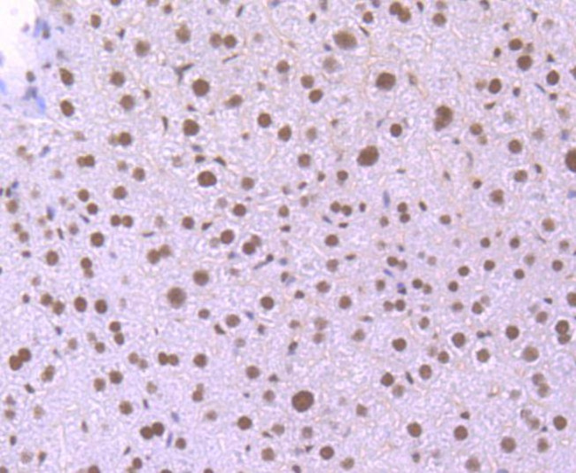 KLF4 Antibody in Immunohistochemistry (Paraffin) (IHC (P))