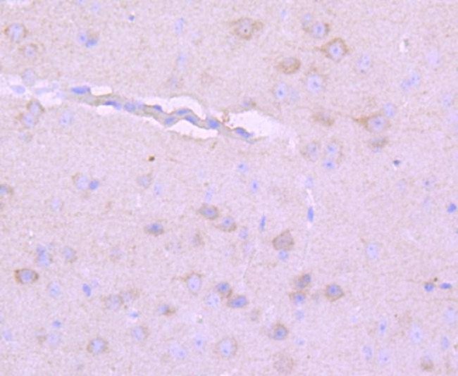 NF-H Antibody in Immunohistochemistry (Paraffin) (IHC (P))