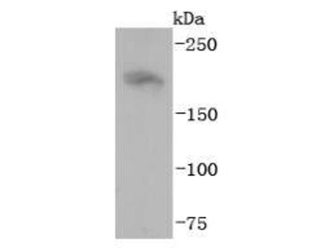 NF-H Antibody in Western Blot (WB)