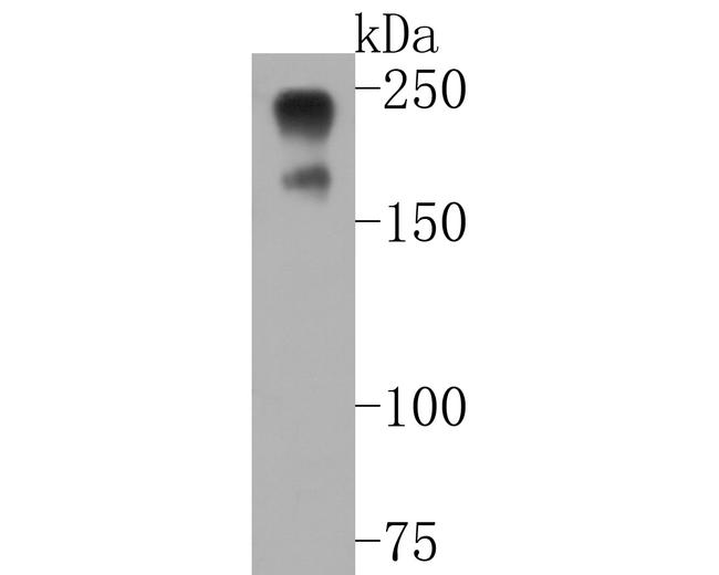 NF-H Antibody in Western Blot (WB)