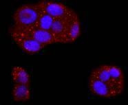 53BP2 Antibody in Immunocytochemistry (ICC/IF)