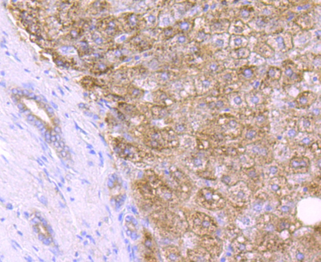 Catalase Antibody in Immunohistochemistry (Paraffin) (IHC (P))