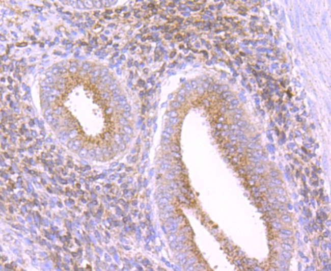 Catalase Antibody in Immunohistochemistry (Paraffin) (IHC (P))