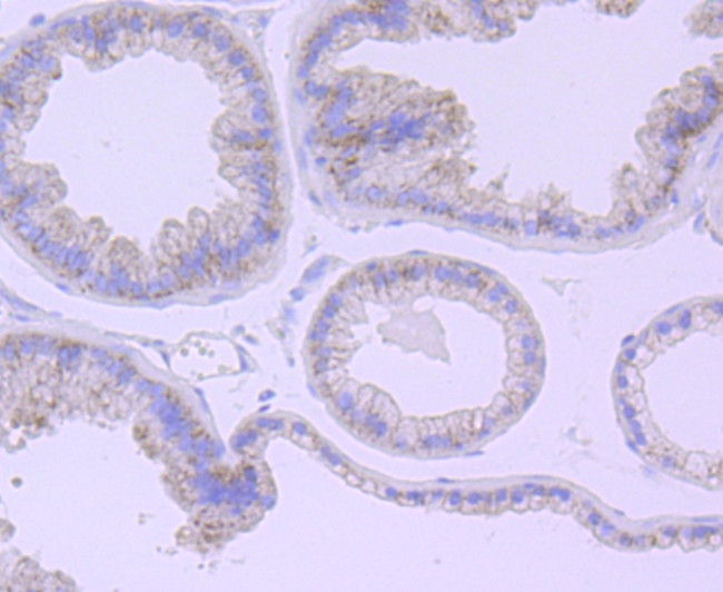 Catalase Antibody in Immunohistochemistry (Paraffin) (IHC (P))