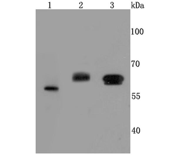 Catalase Antibody in Western Blot (WB)