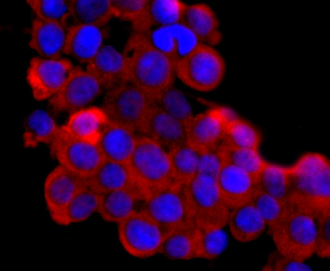 NGAL Antibody in Immunocytochemistry (ICC/IF)