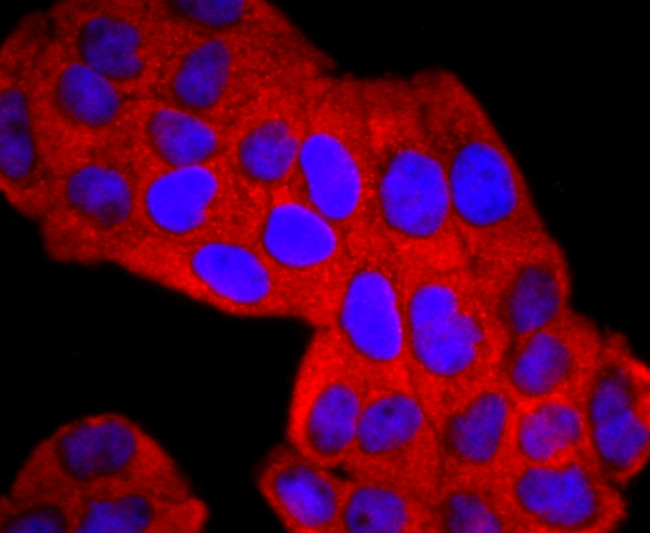 NGAL Antibody in Immunocytochemistry (ICC/IF)