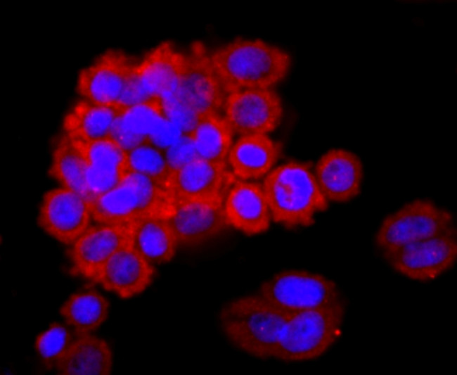 NGAL Antibody in Immunocytochemistry (ICC/IF)