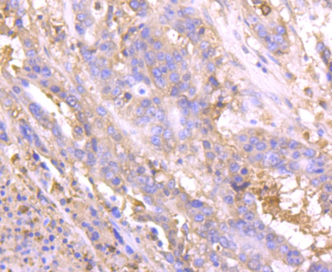 NGAL Antibody in Immunohistochemistry (Paraffin) (IHC (P))