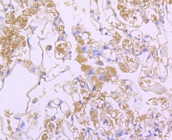 NGAL Antibody in Immunohistochemistry (Paraffin) (IHC (P))