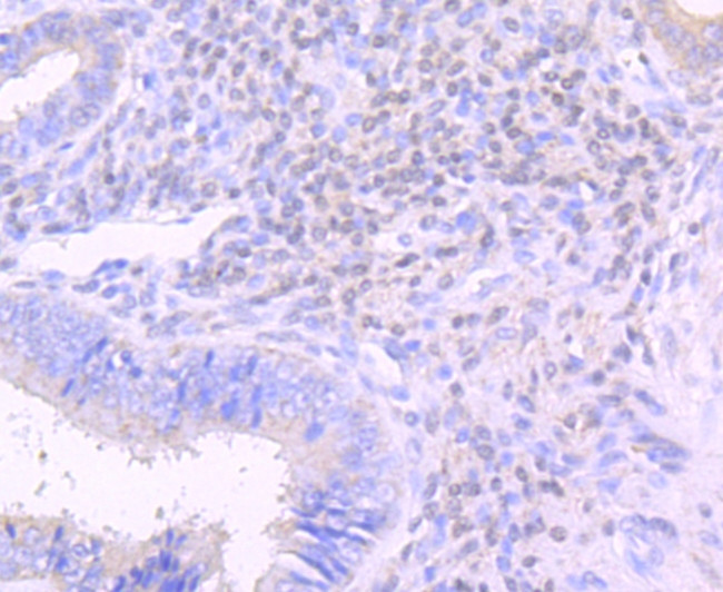 NGAL Antibody in Immunohistochemistry (Paraffin) (IHC (P))