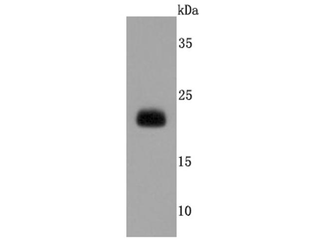 NGAL Antibody in Western Blot (WB)