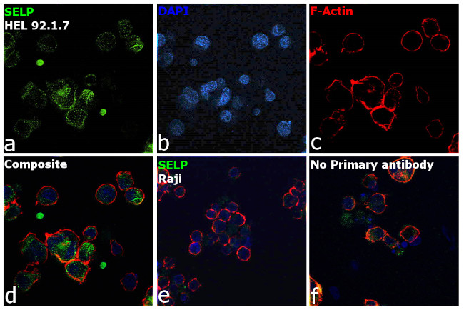 P-Selectin Antibody in Immunocytochemistry (ICC/IF)